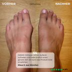 Orthoval Zehkorrektur Schiene