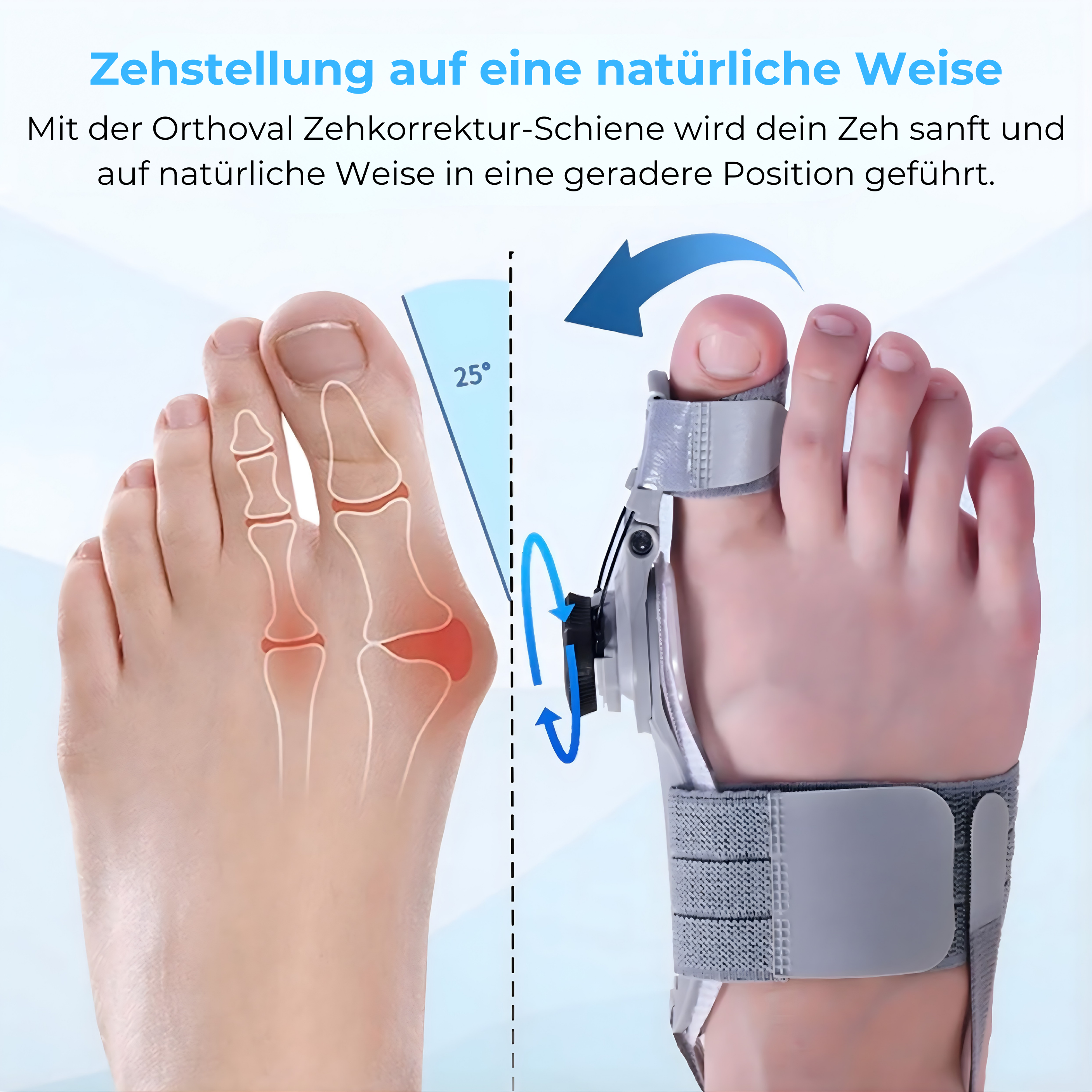 Orthoval Zehkorrektur Schiene