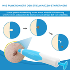 Stielwarzen-Entferner