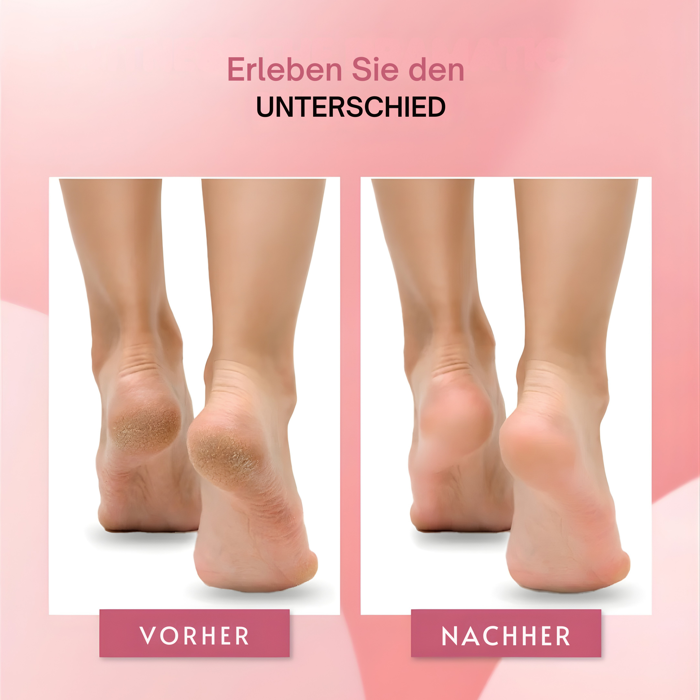 Orthoval Hornhautentferner